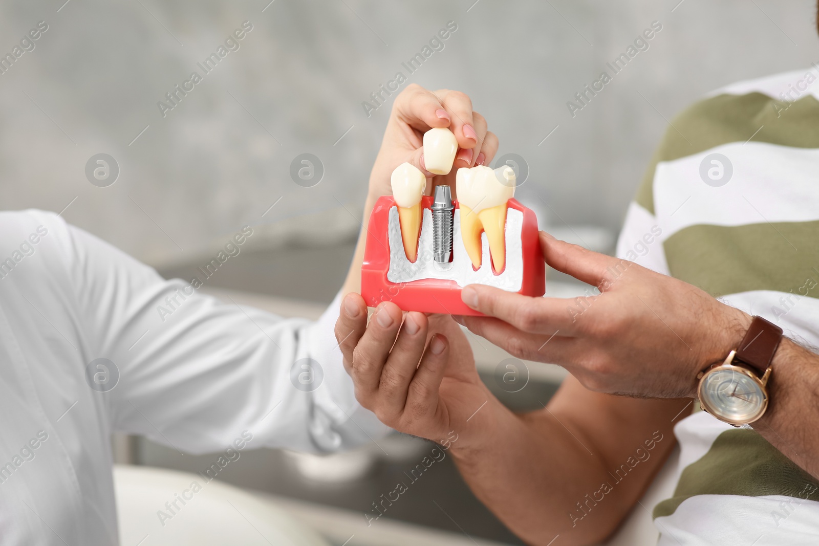 Photo of Doctor with educational model of dental implant consulting patient in clinic, closeup