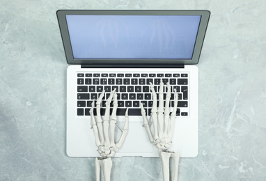 Photo of Human skeleton using laptop at grey marble table, top view